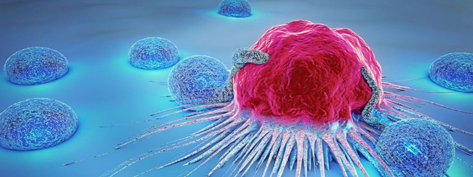 SL Sees 100 New Cancer Cases, 40 Deaths Daily